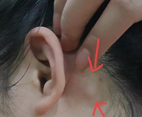 如何解决耳朵过长的问题（从外貌到功能，探讨耳朵太长的解决方案）
