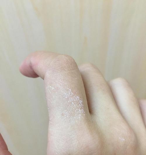 干了怎么办——浇水的正确方法及抢救措施（遇到干燥的土壤，别慌！跟着这些方法一起浇水吧！）